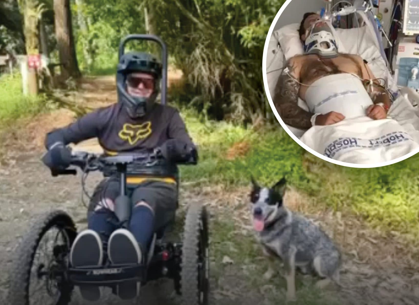 Fundraising Campaign Underway for Adaptive Mountain Bike Trails at Lake Mangamahoe